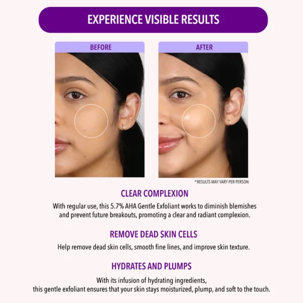 5.7% AHA GENTLE EXFOLIANT - Image 5